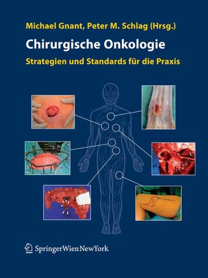 cover image of Chirurgische Onkologie